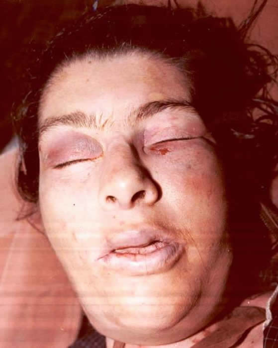 Unidentified Female